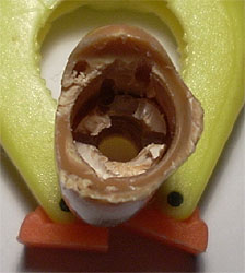 Interior del antebrazo