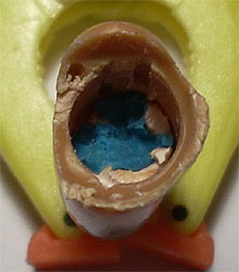 Interior del antebrazo relleno