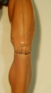 Rodilla deteriorada